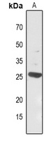 Carbonic Anhydrase 1 Rabbit Polyclonal Antibody