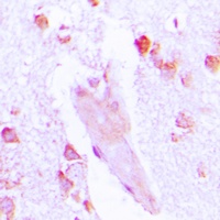 Carbonic Anhydrase 1 Rabbit Polyclonal Antibody