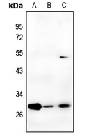 Carbonic Anhydrase 2 Rabbit Polyclonal Antibody