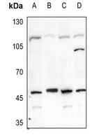 Carbonic Anhydrase 9 Rabbit Polyclonal Antibody