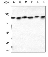 Calnexin (Phospho-S583) Rabbit Polyclonal Antibody