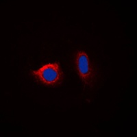 Calnexin (Phospho-S583) Rabbit Polyclonal Antibody