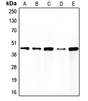 Caspase 1 Rabbit Polyclonal Antibody