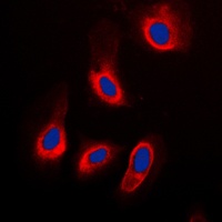 Caspase 3 Rabbit Polyclonal Antibody