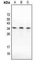Caspase 3 Rabbit Polyclonal Antibody