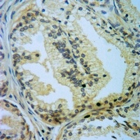 Caspase 5 p10 Rabbit Polyclonal Antibody