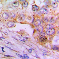 Caspase 6 p18 Rabbit Polyclonal Antibody