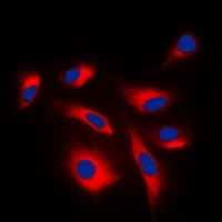 Caspase 6 p18 Rabbit Polyclonal Antibody