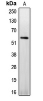 Caspase 8 (Phospho-S347) Rabbit Polyclonal Antibody