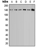 Calcium Sensing Receptor (Phospho-T888) Rabbit Polyclonal Antibody