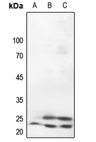 Caveolin 1 Rabbit Polyclonal Antibody