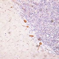 RUNX2 Rabbit Polyclonal Antibody