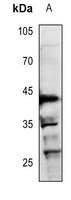 RUNX3 Rabbit Polyclonal Antibody
