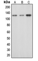 c-CBL (Phospho-Y674) Rabbit Polyclonal Antibody
