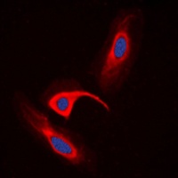 CBR1 Antibody