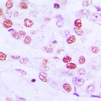 Cyclin E1 Rabbit Polyclonal Antibody