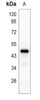 CD1b Antibody