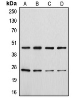 CD28 (Phospho-Y218) Antibody