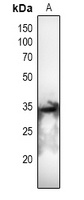 CDC2 (Phospho-T161) Rabbit Polyclonal Antibody