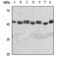 Septin 7 Rabbit Polyclonal Antibody