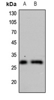 CDC34 Rabbit Polyclonal Antibody