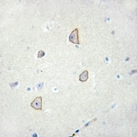 Cadherin 18 Rabbit Polyclonal Antibody