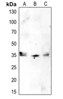 CDK1/2/3 (Phospho-T14) Rabbit Polyclonal Antibody