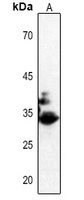 CDK2 (Phospho-T160) Rabbit Polyclonal Antibody
