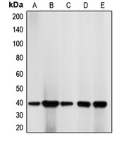 CDK7 Rabbit Polyclonal Antibody