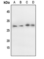 p27 Kip1 (Phospho-T198) Rabbit Polyclonal Antibody