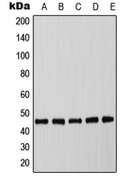 C/EBP alpha (Phospho-T226) Rabbit Polyclonal Antibody