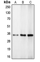 C/EBP beta Antibody