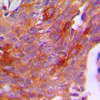 CG beta Rabbit Polyclonal Antibody