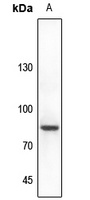 CHAT Rabbit Polyclonal Antibody
