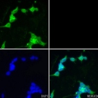CHAT Rabbit Polyclonal Antibody