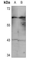 CHK1 (Phospho-S286) Rabbit Polyclonal Antibody