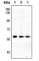 CHK1 (Phospho-S317) Rabbit Polyclonal Antibody