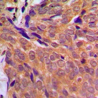 CHK1 Rabbit Polyclonal Antibody