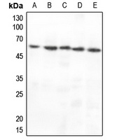 CHK1 Rabbit Polyclonal Antibody