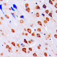 CHK1 Rabbit Polyclonal Antibody