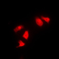 CHK1 Rabbit Polyclonal Antibody