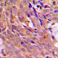 CHK1 Rabbit Polyclonal Antibody