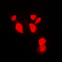 CHK1 Rabbit Polyclonal Antibody
