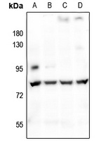 CHML Rabbit Polyclonal Antibody