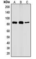 IKK alpha (Phospho-T23) Rabbit Polyclonal Antibody