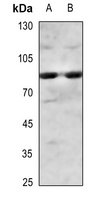 IKK alpha/beta (Phospho-S180/181) Rabbit Polyclonal Antibody
