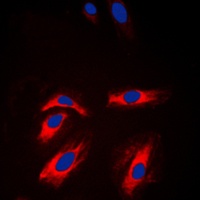 Creatine Kinase M Rabbit Polyclonal Antibody