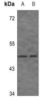 AP2M1 Rabbit Polyclonal Antibody