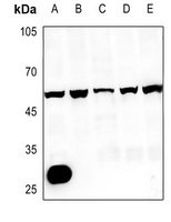 CMKLR1 Rabbit Polyclonal Antibody