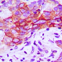 CMKLR1 Rabbit Polyclonal Antibody